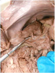 Kidneys - Fetal Pig